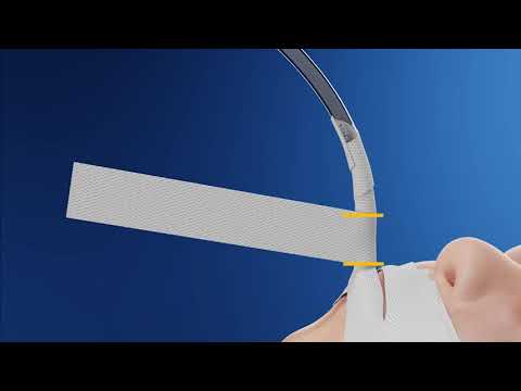 Endotracheal Tube Securement - Demonstration of Pants Technique