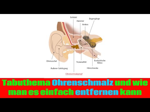 Tabuthema Ohrenschmalz und wie man es einfach entfernen kann