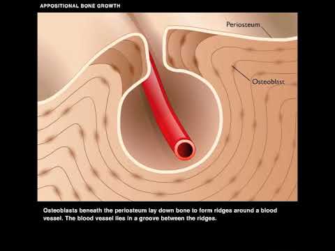 Appositional Bone Growth