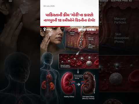 Pakistaniની ક્રીમ 'ગોરી'ના કારણે નાગપુરની 18 મહિલાને કિડનીના રોગ! | Gujarat Samachar Pakistaniની ક્રીમ 'ગોરી'ના કારણે નાગપુરની 18 મહિલાને કિડનીના રોગ! | Gujarat Samachar
