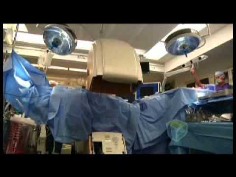 Healthy Living: Back surgery - Essentia Health