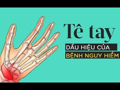 , title : 'Bị tê tay vào ban đêm là dấu hiệu cảnh báo hội chứng ống cổ tay rất nguy hiểm'