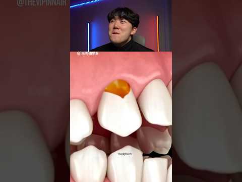 Try Not to Laugh Challenge 1148 🤣 #funny ⁠#shorts #viral