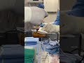Hip Augmentation With Implants Transgender Female Body Surgery