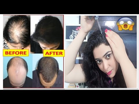 Hair Serum Retailers & Dealers in India
