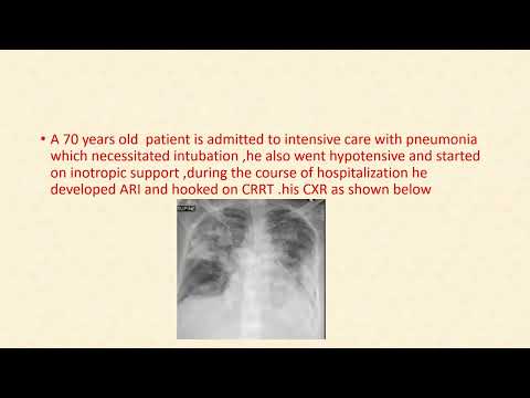 ACS/CCS/Heart failure, Dr. Hatim kheirallah, 24/7/2022