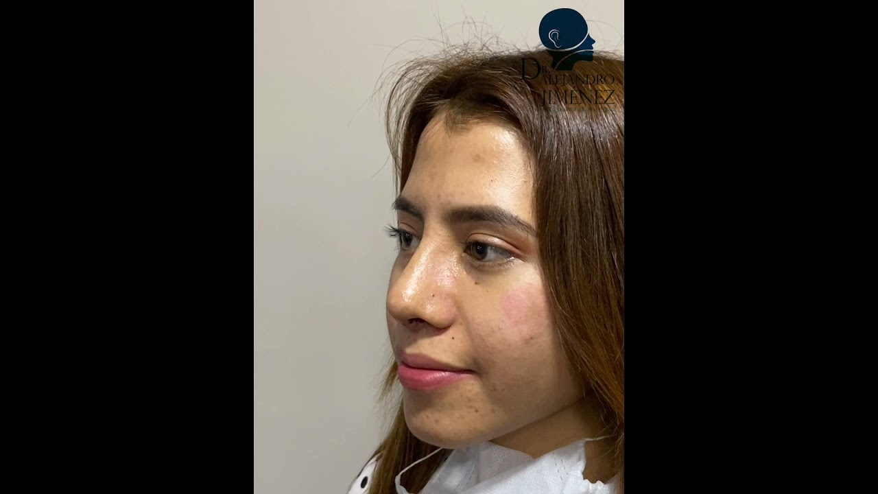 Alejandro Jimenez Garcia-62