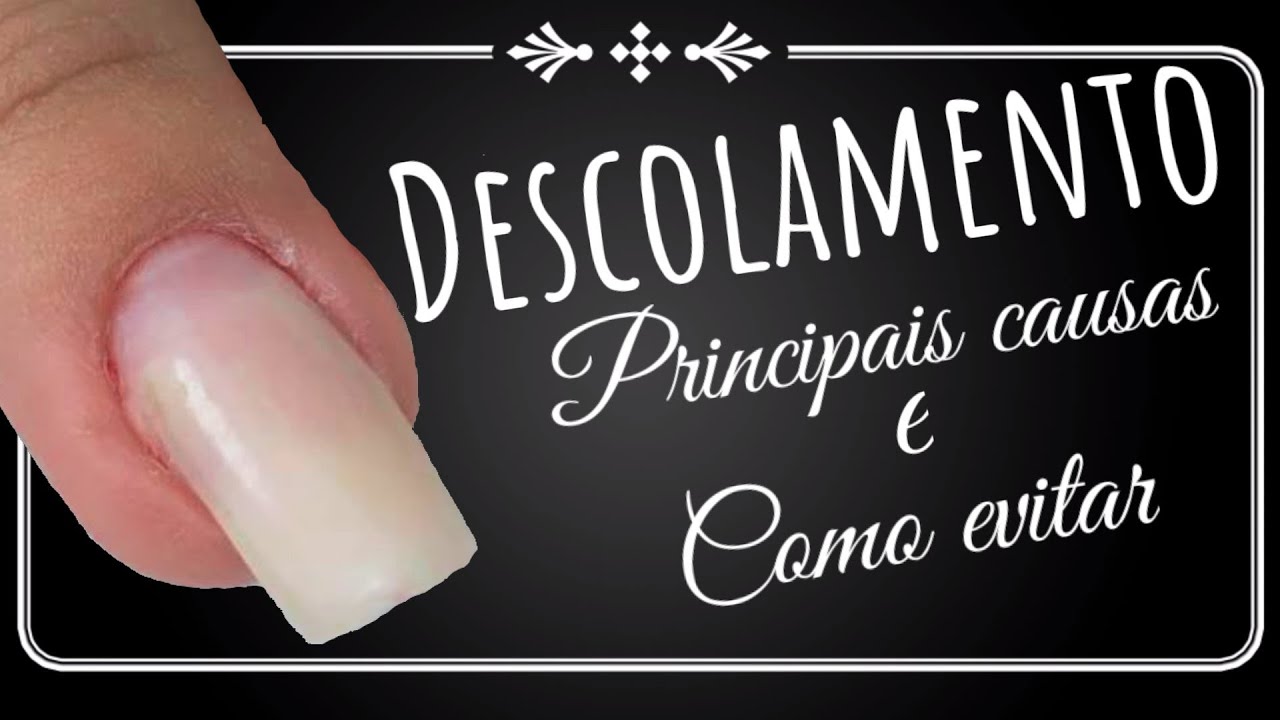 Watch Now DESCOLAMENTO NO ALONGAMENTO DE UNHAS DE GEL - PRINCIPAIS CAUSAS E COMO EVITAR DESCOLAMENTO NO ALONGAMENTO DE UNHAS DE GEL - PRINCIPAIS CAUSAS E COMO EVITAR