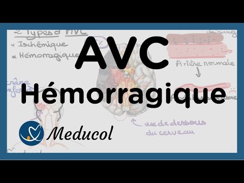 La médecine à base de plantes dans le traitement de lhypertension Traitement de lhypertension sanatorium en Russie