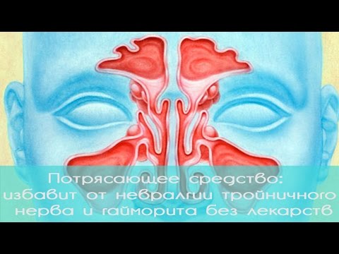 Шейной межпозвонковой грыжи Разрыв заднего рога медиального мениска коленного сустава причины