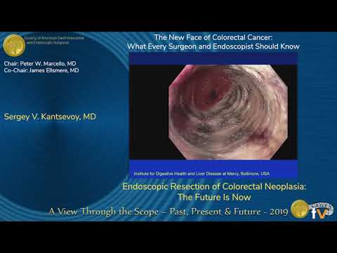 Endoscopic Resection of Colorectal Neoplasia: The Future Is Now