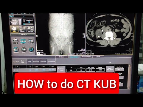 CT scan KUB Protocol.