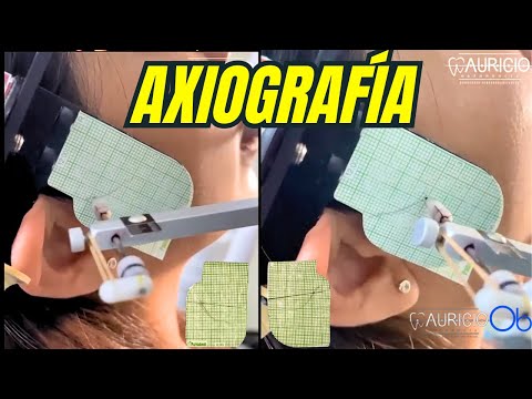 AXIOGRAFÍA