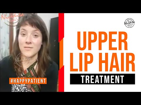 Upper Lip Hair Treatment