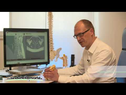 Bandscheibenvorfall C6C7 und C5C6