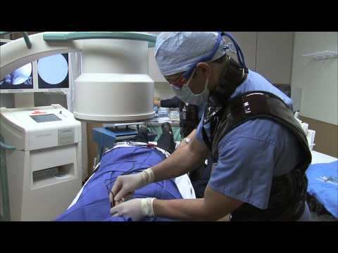 SSM Pain Care radiofrequency ablation for neck pain