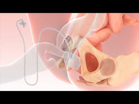 Fetal Pillow Animation - Key Steps for Use