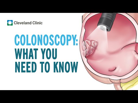 Colonoscopy: What you Need to Know