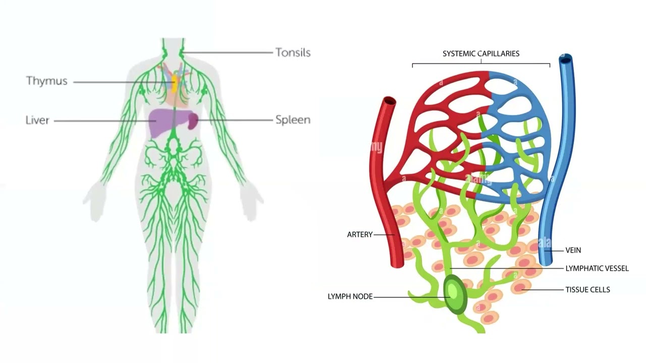 Lymphedema and Ovarian Cancer
