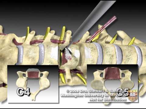 Sie die Schwellung der Osteochondrose entfernen Alle von den Erkrankungen der Fußgelenke