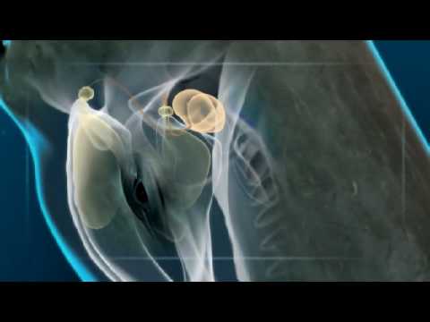 Sperm whale vs giant squid