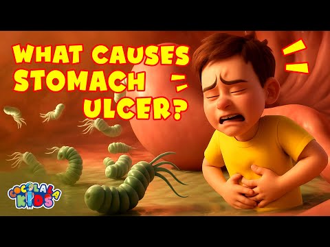 The Cause of Stomach Ulcers | Gastric & Peptic Ulcers? | Stomach's Digestion | Prof. Coco Show