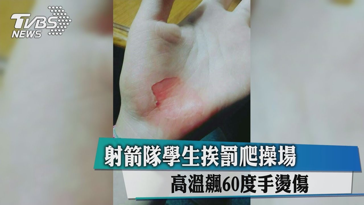 射箭隊學生挨罰爬操場　高溫飆60度手燙傷