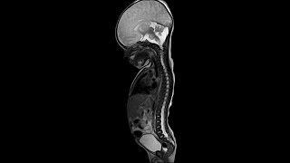 Case of the Day - 25 Nov 24