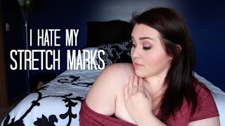 "I Hate My Stretch Marks!"
