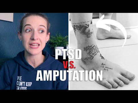 PTSD was worse than losing my leg - here's why