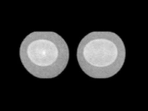 Eggs MRI - Sixty Symbols
