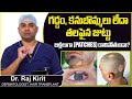 జుట్టు పట్టీల రాలితే Alopecia Areata Causes And Symptoms Patchy 