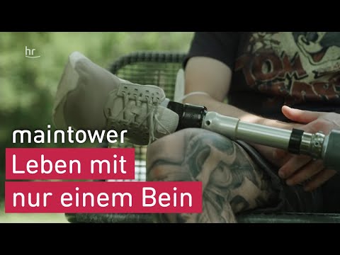 Living with an Amputation | maintower