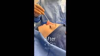 Dr. Courtney Plastic Surgery