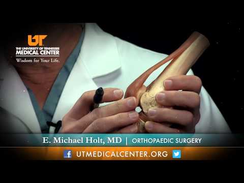 Three Knee Surgery Approaches - Dr. Holt