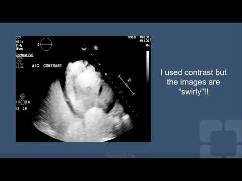 Ss11 Imaging the Failing Heart A Sonographer's Perspective Freemedbooks.com
