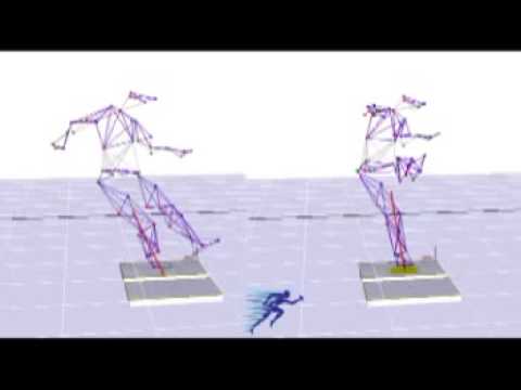 Pré vs Pós op artroscopia quadril Dr Lourenço Peixoto