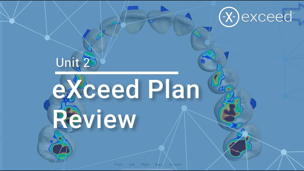 Unit 2 - eXceed Plan Review