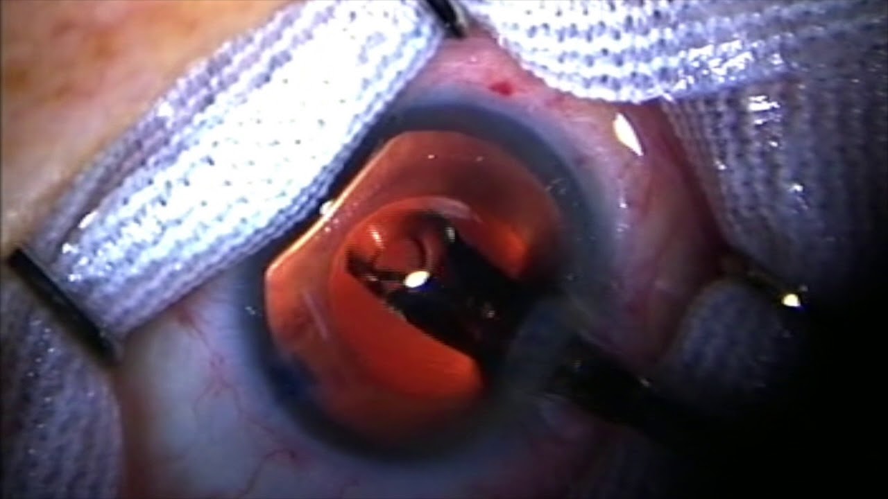 Jairo Hoyos Chacón-16