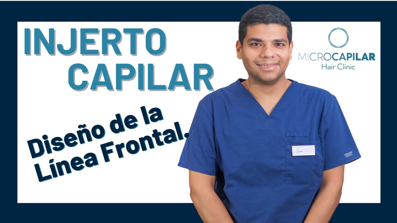 Watch 👨⚕️TODO lo que necesitas saber sobre el diseño de la LÍNEA FRONTAL en la cirugía de INJERTO CAPILAR Now 👨⚕️TODO lo que necesitas saber sobre el diseño de la LÍNEA FRONTAL en la cirugía de INJERTO CAPILAR
