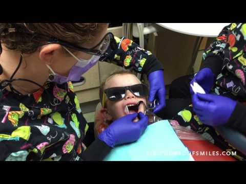 Silver Diamine Fluoride Application