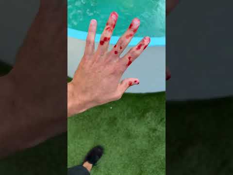 WHEN JAWS Attack you p.2