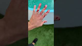 WHEN JAWS Attack you p.2