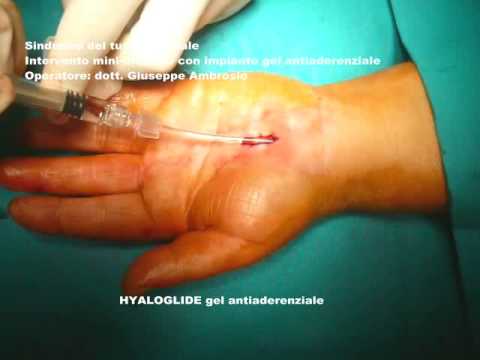 Che ha curato osteocondrosi della colonna cervicale Mal di schiena sotto il trattamento costola destra