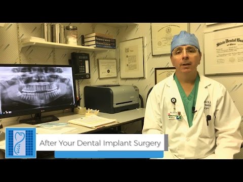 Instructions For After Your Dental Implant Procedure