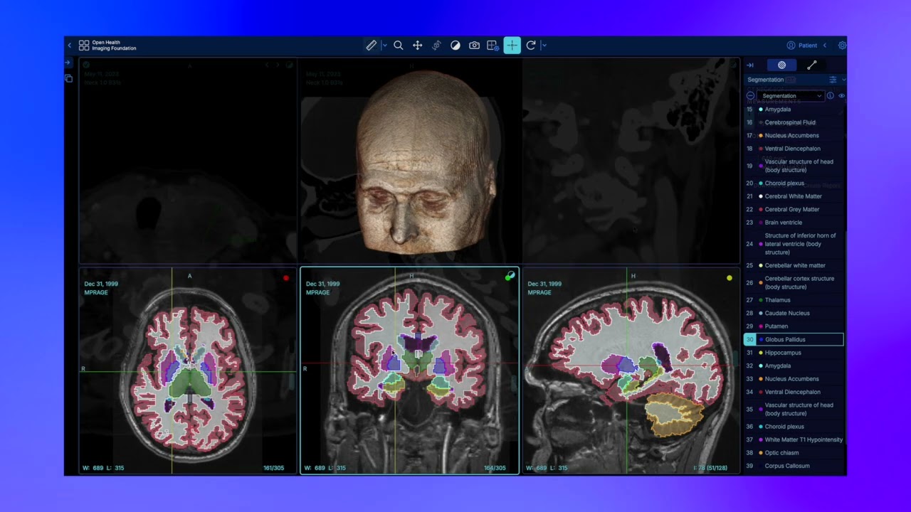 Introduction to the Open Health Imaging Foundation (OHIF) Viewer