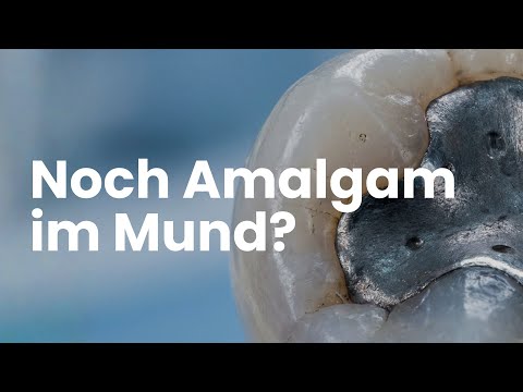 Should I really have my amalgam fillings removed?