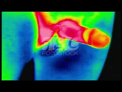 Educational thermal image erection