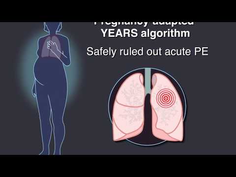 Pulmonary Embolism and Diagnostic CT in Pregnancy