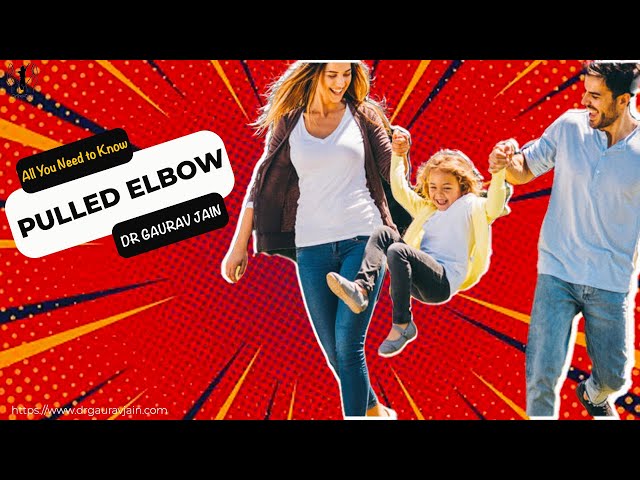 Torticollis Treatment